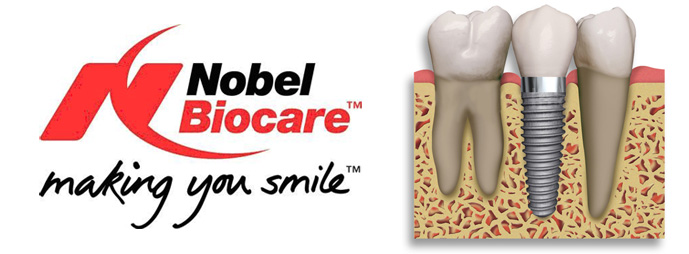 nobel-biocare-smile